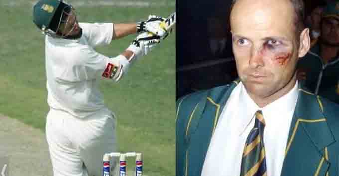 Cricket Facts: গুরুতর চোট সত্ত্বেও এই ৫ খেলোয়াড় ছাড়েননি মাঠ, তালিকায় সামিল ভারতীয় খেলোয়াড়ও 1
