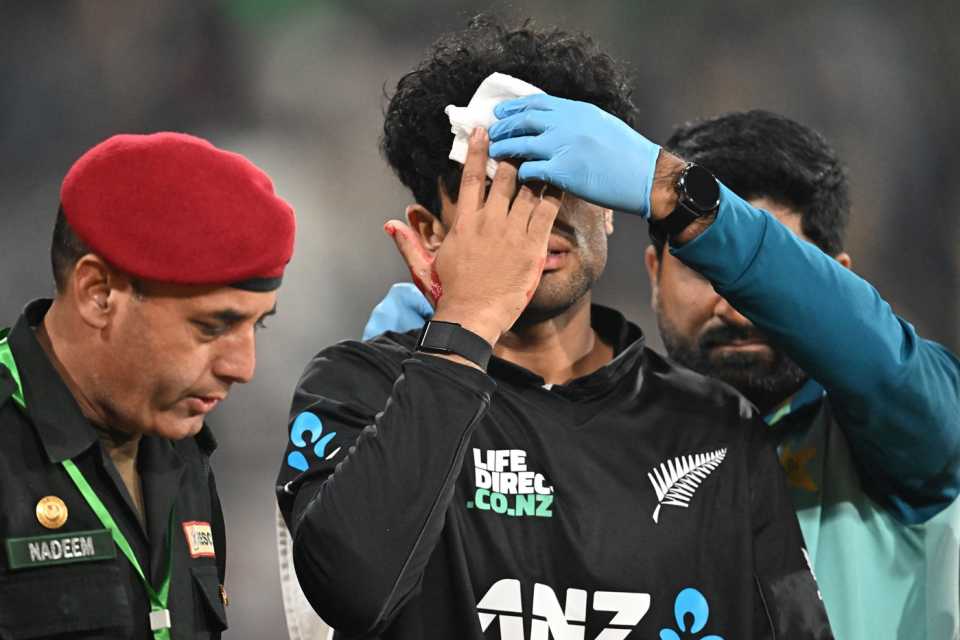 চ্যাম্পিয়ন্স ট্রফির আগে দুঃসংবাদ, কপাল ফেটে হাসপাতালে ভর্তি তারকা ক্রিকেটার !! 3 Champions trophy 2025