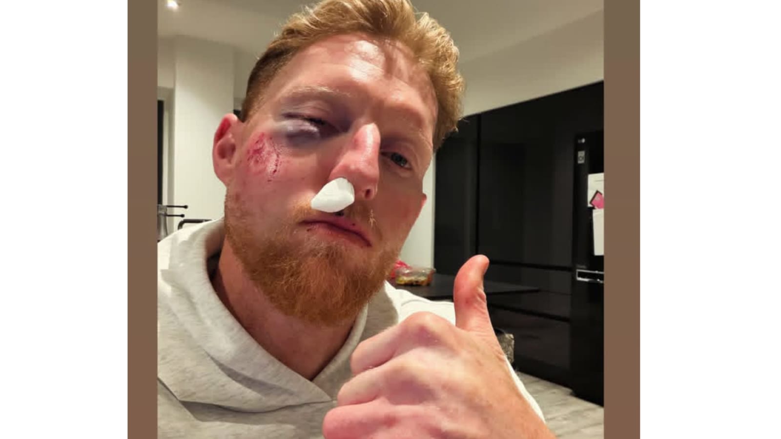 বিশ্বকাপের আগেই গুরুতর চোট তারকা পেসারের, অনুশীলন করার সময় বিপত্তি !! 3